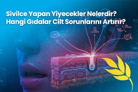 Sivilce Yapan Yiyecekler Nelerdir? Hangi Gıdalar Cilt Sorunlarını Artırır?