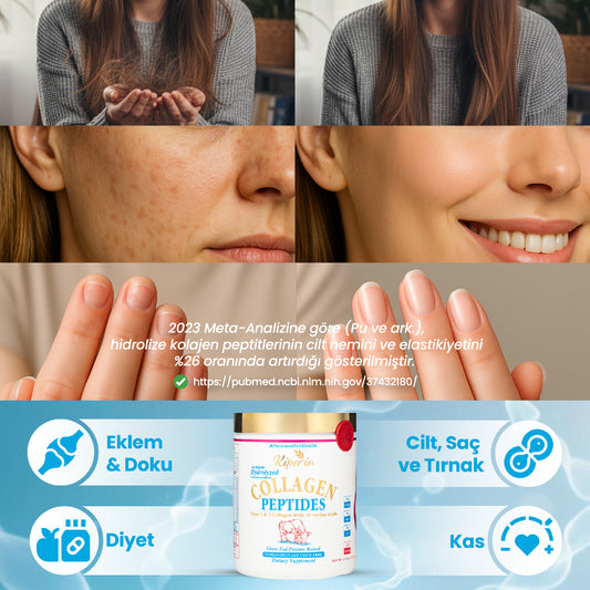 Kiperin Collagen Classic (500gr) %100 Saf ve Doğal Yüksek Biyoaktif Çift Hidrolize Kolajen Peptitleri içeren Takviye Edici Gıda